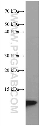 S100A4 Antibody in Western Blot (WB)