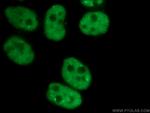 CCAR2 Antibody in Immunocytochemistry (ICC/IF)