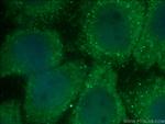 TRAF6 Antibody in Immunocytochemistry (ICC/IF)