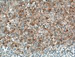 CD40L/CD154 Antibody in Immunohistochemistry (Paraffin) (IHC (P))