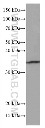 MDH1 Antibody in Western Blot (WB)