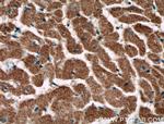 CNOT1 Antibody in Immunohistochemistry (Paraffin) (IHC (P))