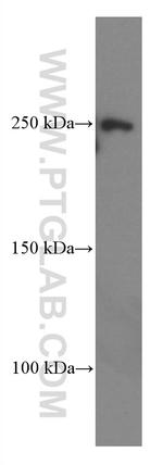 CNOT1 Antibody in Western Blot (WB)