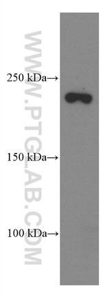 CNOT1 Antibody in Western Blot (WB)