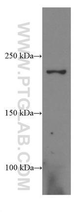 CNOT1 Antibody in Western Blot (WB)