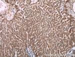 F2 Antibody in Immunohistochemistry (Paraffin) (IHC (P))