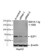 E2F1 Antibody in Western Blot (WB)