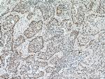 PARP1 Antibody in Immunohistochemistry (Paraffin) (IHC (P))