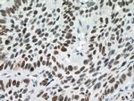 PARP1 Antibody in Immunohistochemistry (Paraffin) (IHC (P))