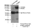 PARP1 Antibody in Immunoprecipitation (IP)