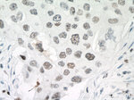 PARP1 Antibody in Immunohistochemistry (Paraffin) (IHC (P))