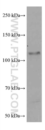 PARP1 Antibody in Western Blot (WB)