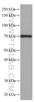 SIAE Antibody in Western Blot (WB)