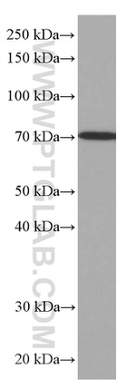 SIAE Antibody in Western Blot (WB)