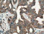 p65/RELA Antibody in Immunohistochemistry (Paraffin) (IHC (P))