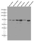 p65/RELA Antibody in Western Blot (WB)