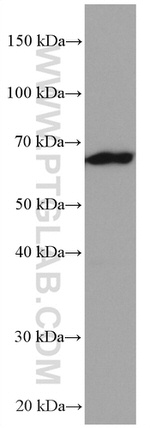 NUP62 Antibody in Western Blot (WB)