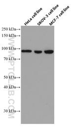 KAT2A/GNC5 Antibody in Western Blot (WB)