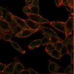 SOX4 (Master Regulator of Epithelial-Mesenchymal Transition) Antibody in Immunocytochemistry (ICC/IF)