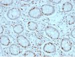 SOX4 (Master Regulator of Epithelial-Mesenchymal Transition) Antibody in Immunohistochemistry (Paraffin) (IHC (P))