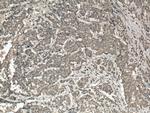 PALLD/palladin Antibody in Immunohistochemistry (Paraffin) (IHC (P))