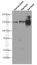 PALLD/palladin Antibody in Western Blot (WB)