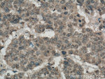 PALLD/palladin Antibody in Immunohistochemistry (Paraffin) (IHC (P))