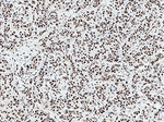 KU70/XRCC6 Antibody in Immunohistochemistry (Paraffin) (IHC (P))