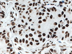 KU70/XRCC6 Antibody in Immunohistochemistry (Paraffin) (IHC (P))