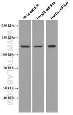 PC Antibody in Western Blot (WB)