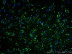 RIC8A Antibody in Immunohistochemistry (PFA fixed) (IHC (PFA))