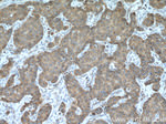 EIF4E Antibody in Immunohistochemistry (Paraffin) (IHC (P))