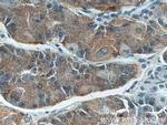 Beclin 1 Antibody in Immunohistochemistry (Paraffin) (IHC (P))