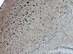 PARK2/Parkin Antibody in Immunohistochemistry (Paraffin) (IHC (P))