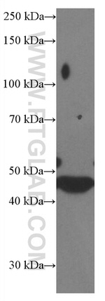 PARK2/Parkin Antibody in Western Blot (WB)