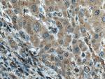 MLKL Antibody in Immunohistochemistry (Paraffin) (IHC (P))