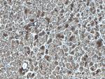 AKR7A2 Antibody in Immunohistochemistry (Paraffin) (IHC (P))