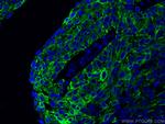 Cytokeratin 13 Antibody in Immunohistochemistry (PFA fixed) (IHC (PFA))