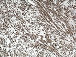 CALD1 Antibody in Immunohistochemistry (Paraffin) (IHC (P))