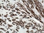 CALD1 Antibody in Immunohistochemistry (Paraffin) (IHC (P))