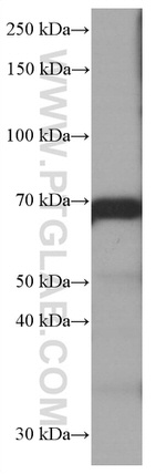 CALD1 Antibody in Western Blot (WB)