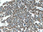 ATP5O Antibody in Immunohistochemistry (Paraffin) (IHC (P))