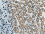 ATP5O Antibody in Immunohistochemistry (Paraffin) (IHC (P))