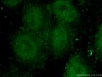 LIG4 Antibody in Immunocytochemistry (ICC/IF)