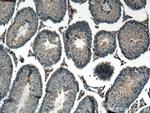 KIAA0652 Antibody in Immunohistochemistry (Paraffin) (IHC (P))