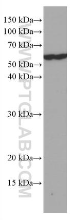 KIAA0652 Antibody in Western Blot (WB)