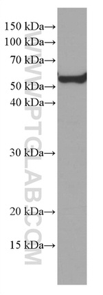 KIAA0652 Antibody in Western Blot (WB)