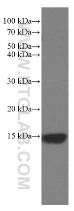 RBX1 Antibody in Western Blot (WB)