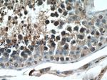 STK11 Antibody in Immunohistochemistry (Paraffin) (IHC (P))