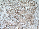 STK11 Antibody in Immunohistochemistry (Paraffin) (IHC (P))